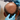 Top 6 Questions About the Hair Transplant