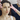 Achieve a Youthful Look with a Non-Surgical Facelift in Glasgow