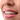 Are Invisalign Braces Affordable in Dubai?