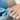 Minimally Invasive Bunion Surgery