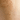 Skin Tag Removal Dubai: Safe and Swift Solutions