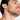 Best Beard Hair Transplant in Dubai: Affordable Options