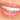 Bright Smile, Right Price: Teeth Whitening Costs in Dubai Revealed!