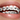 What Are the Different Types of Braces?