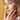 Are You Ready for Melasma Treatment? Find Out Now!