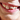 How to Correct Overlapping Teeth: A Comprehensive Guide