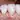 Achieving a Bright Smile: Everything You Need to Know About Dental Veneers