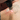 How Does Skin Type Affect Laser Tattoo Removal Results?