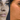 How Rhinoplasty in Dubai is Evolving with 3D Imaging Technology