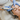 Can Hydrafacials Help with Acne? Exploring the Benefits