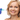When to Start Botox: Best Dermatologist Guide
