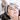 The Ultimate Glow Booster: Fractional RF Microneedling