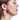 Safe and Effective Birthmark Removal in Islamabad