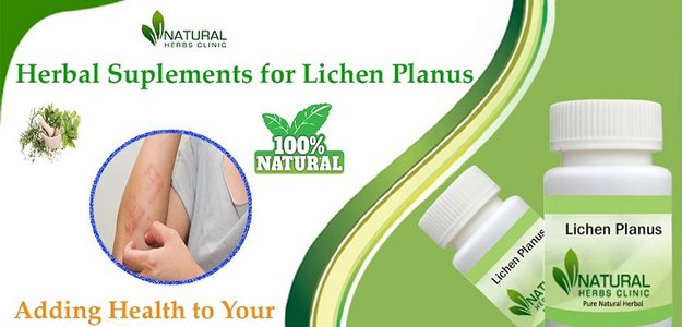 Lichen Planus Relief: 7 Natural Solutions for Long-Lasting Results