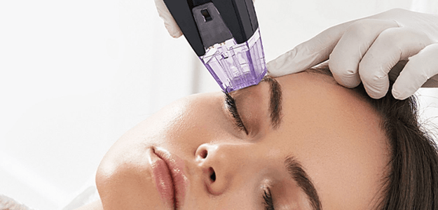 Get the Glow Back with Morpheus8 Treatment Magic