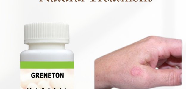 The Ultimate Guide to Naturally Treating Granuloma Annulare
