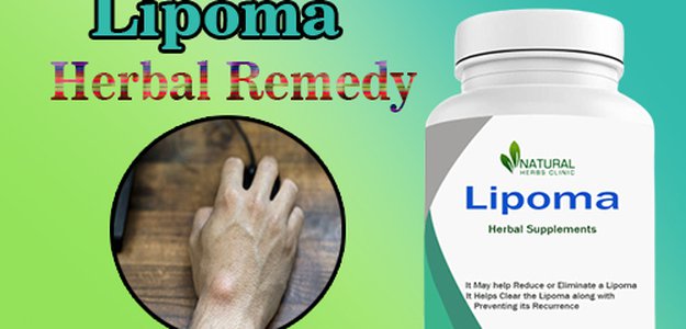 Natural Ways To Cure Lipoma Permanently: Effective Home Remedies