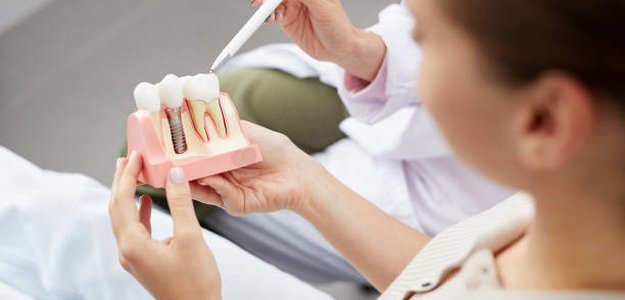 Discover the Benefits of Dental Implants in Austin: A Comprehensive Guide