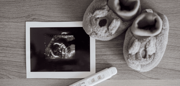 What to Expect During a Baby Scan: A Complete Guide for Parents-to-Be