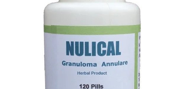 Healing Granuloma Annulare: 5 Herbal Supplements You Need to Know