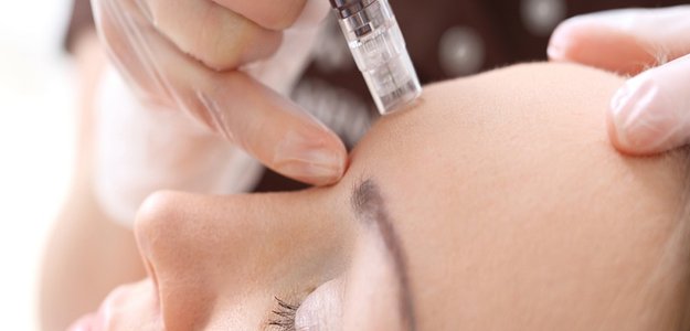 Mesotherapy vs. Other Cosmetic Treatments: What You Need to Know