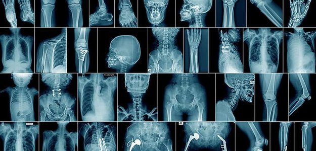 Boost Your Radiology Career: CE Requirements in California