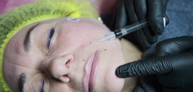 Why Cheek Augmentation in Orange County is the Secret to a Youthful Appearance