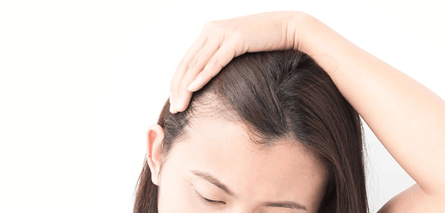 Comprehensive Guide to Hair Loss Treatments in Dubai