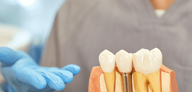 Recovering from a Dental Implant