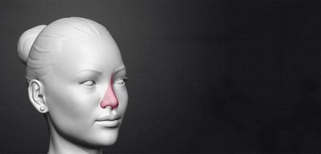 The Role of Nasal Feminization Rhinoplasty in Transgender Surgery