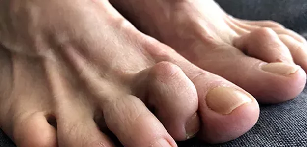 Comprehensive Care for Foot and Ankle Health