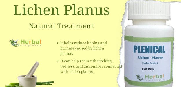 Heal Lichen Planus Naturally: Safe and Simple Remedies You Can Try Now