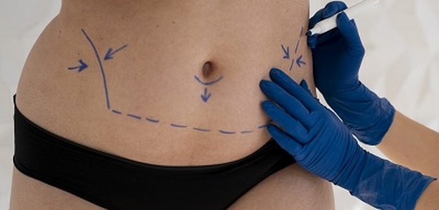 Leading Tummy Tuck Surgery in Islamabad – Choose Glamorous Clinic