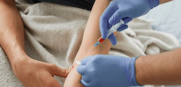 Can Spider Veins Treatment Enhance Confidence?