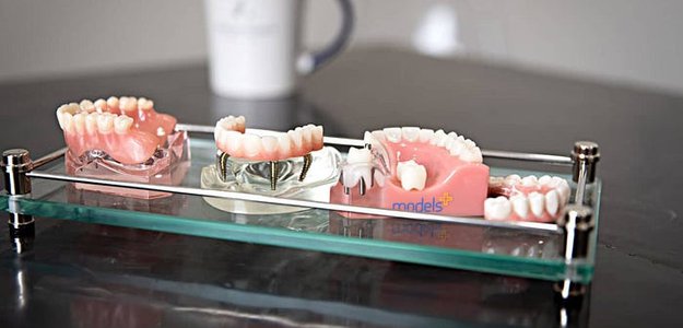 Dental Implant Dallas: Transform Your Smile