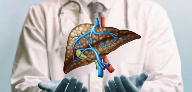 What Are Effective Liver Cirrhosis Treatments?