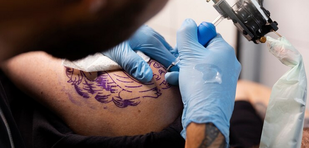 Erase Your Past: The Complete Guide to Laser Tattoo Removal in Glasgow