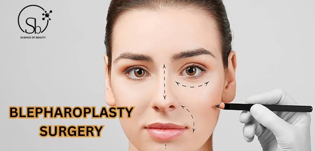 Why is blepharoplasty surgery becoming trending among females?