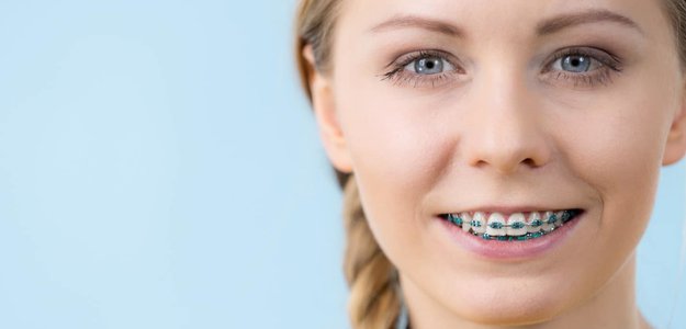 Underbite Braces vs. Surgery: Which Is Right for You?