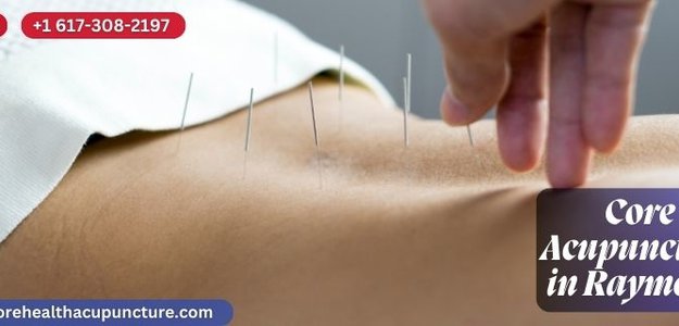 Core Acupuncture in Raymond, NH: Your Path to Holistic Healing
