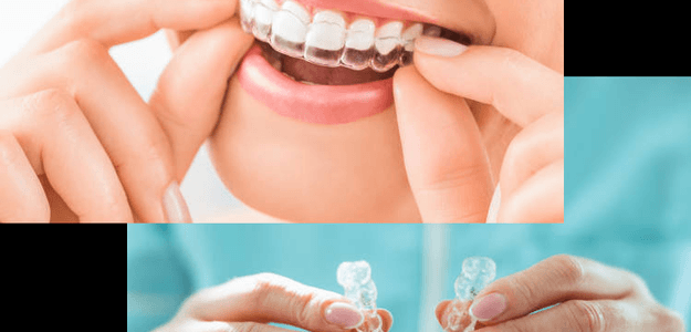 Invisalign in Barrie, Orthodontic Treatment in Barrie | Barrie Dental