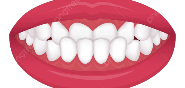 Achieving Whiter Teeth with Crest Whitestrips on Misaligned Teeth