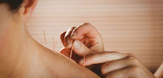 Why Should You Choose Acupuncture Edmonton for Pain Relief?