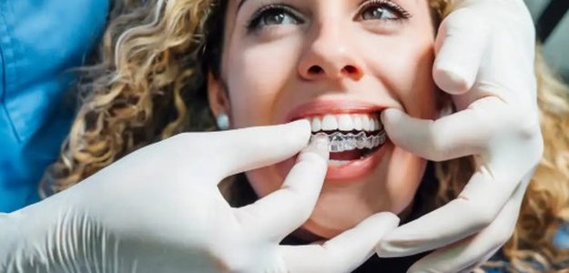 Invisalign Strathpine