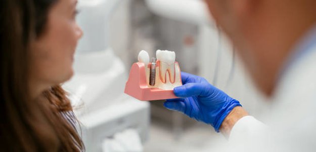 Exploring Toronto Dental Implants: Your Comprehensive Guide to Advanced Tooth Restoration