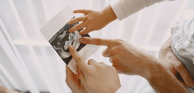 Exploring 3D Pregnancy Scans: Technology Bringing Baby's First Images to Life