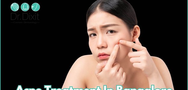 What Is The Main Cause Of Acne On The Face?