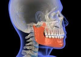 TMJ Placement Injury