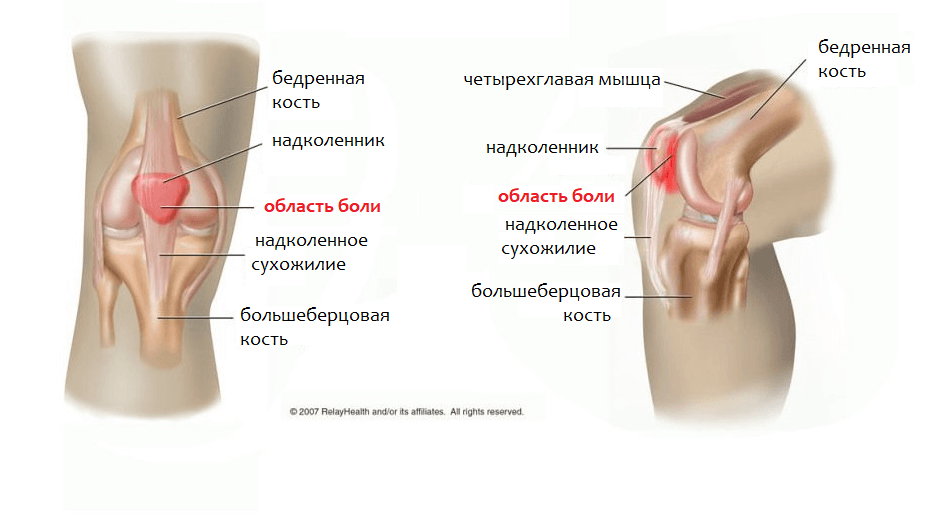 Боль под коленом